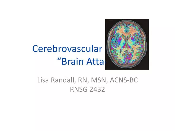 cerebrovascular accident brain attack