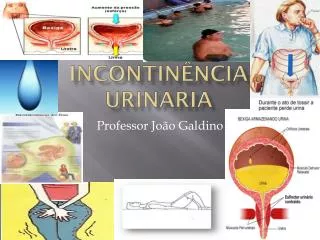 incontin ncia urinaria