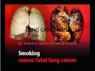 LUNG CANCER!!!!!