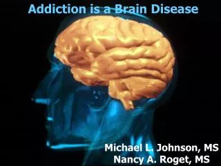 Addiction is a Brain Disease