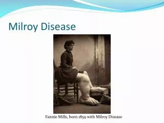 Milroy Disease