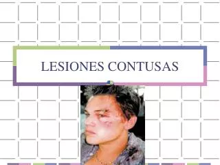 lesiones contusas