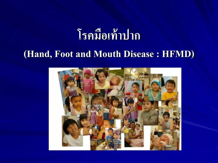 hand foot and mouth disease hfmd
