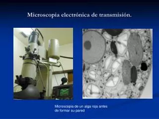 microscopia electr nica de transmisi n