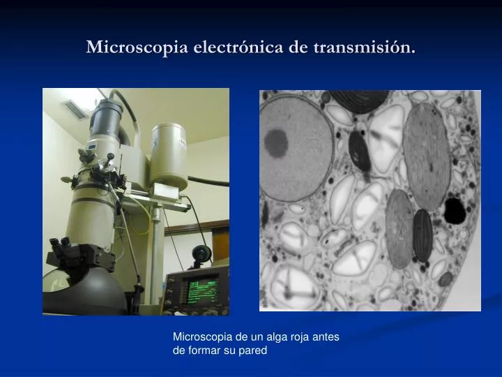 microscopia electr nica de transmisi n