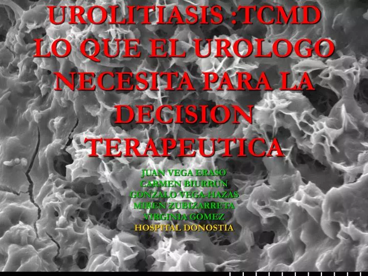 urolitiasis tcmd lo que el urologo necesita para la decision terapeutica