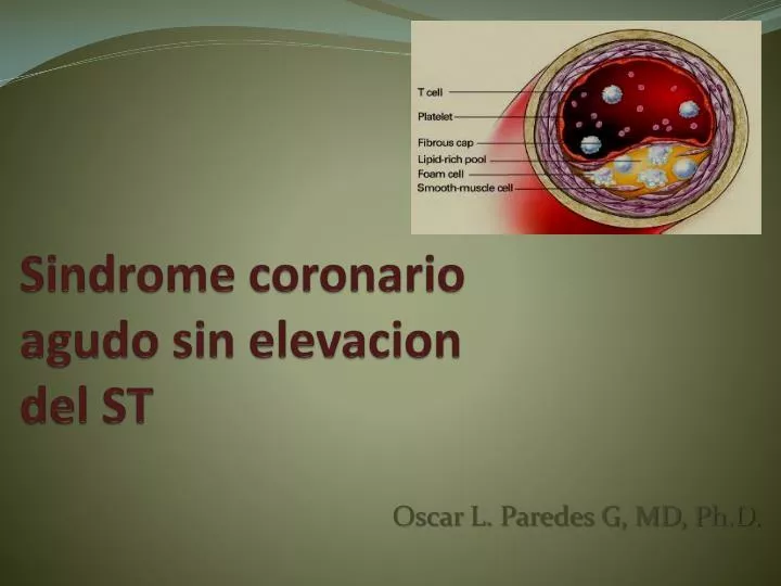 sindrome coronario agudo sin elevacion del st