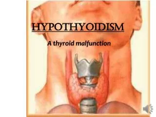 Hypothyoidism