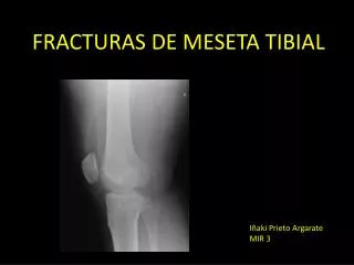 fracturas de meseta tibial