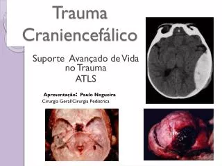 trauma craniencef lico