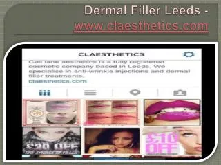 Dermal Filler Leeds - www.claesthetics.com