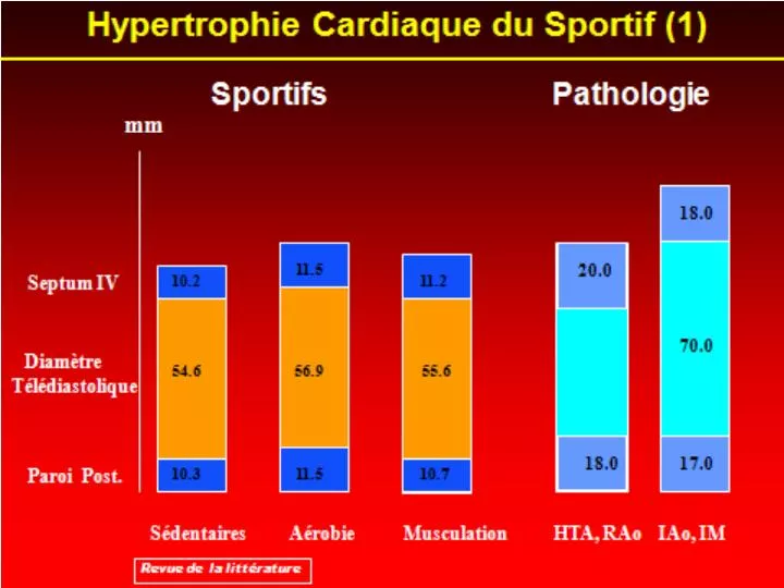 hypertrophie cardiaque du sportif