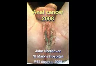 Anal cancer 2008
