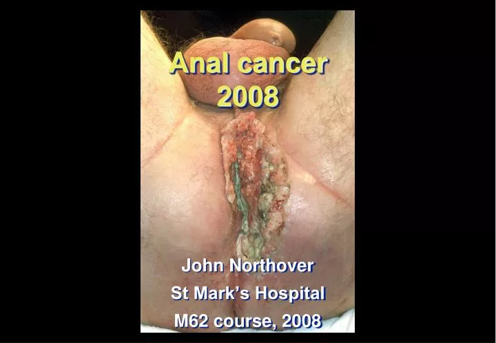 anal cancer 2008