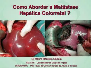 como abordar a met stase hep tica colorretal