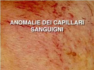 anomalie dei capillari sanguigni