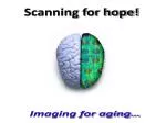 PET Imaging for Early Alzheimer's Disease Detection: A Ray of Hope! - slide 1