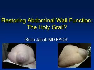 Restoring Abdominal Wall Function: The Holy Grail?