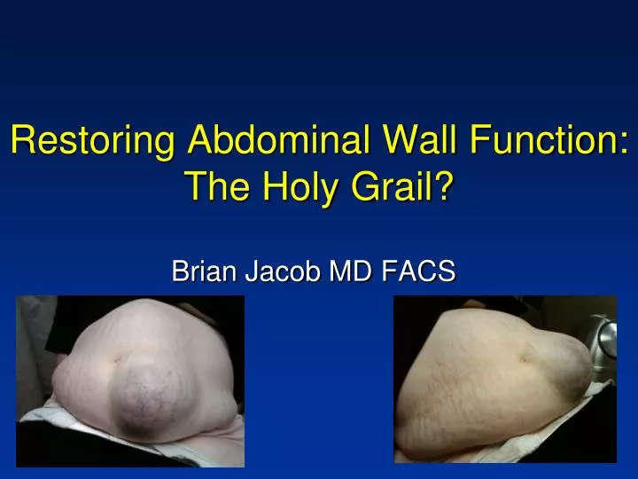 restoring abdominal wall function the holy grail