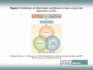 Figure 2 Contribution of inflammation and fibrosis to lower urinary tract dysfunction (LUTD)