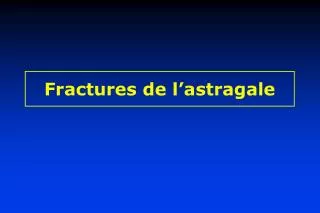 fractures de l astragale