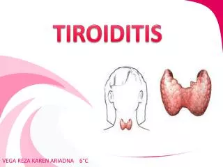 tiroiditis
