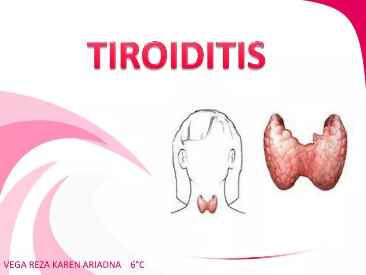tiroiditis