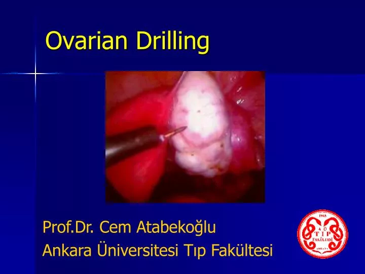 ovarian drilling