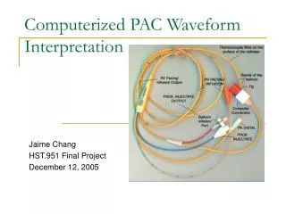 Computerized PAC Waveform Interpretation