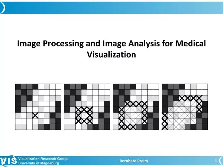 image processing and image analysis f o r medical visualization