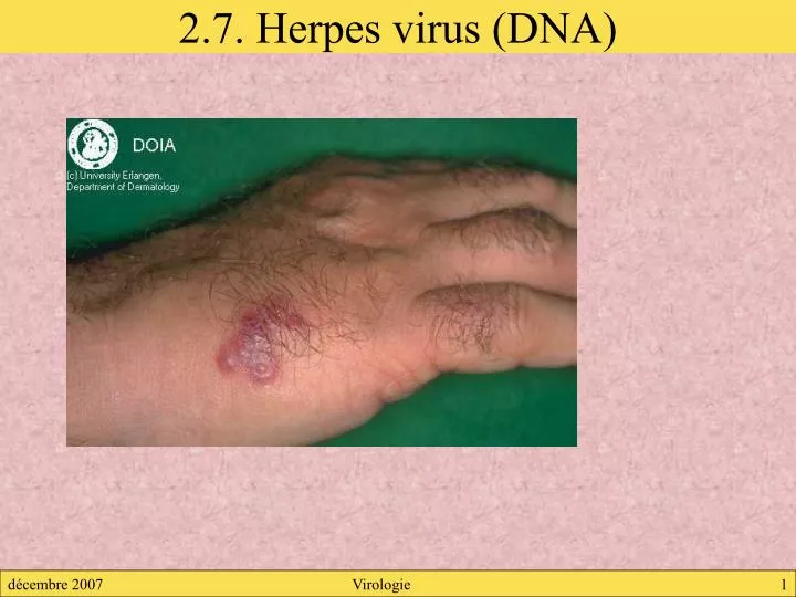 2 7 herpes virus dna