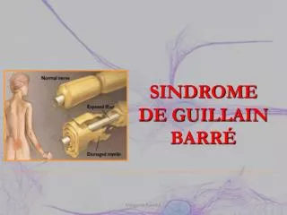 SINDROME DE GUILLAIN BARRÉ