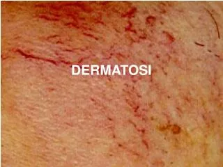 dermatosi