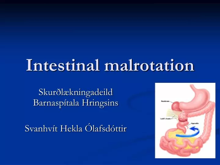 intestinal malrotation