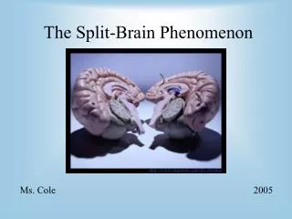 The Split-Brain Phenomenon