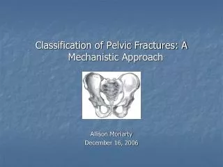 Classification of Pelvic Fractures: A Mechanistic Approach Allison Moriarty December 16, 2006