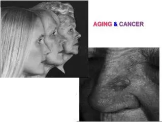 AGING &amp; CANCER