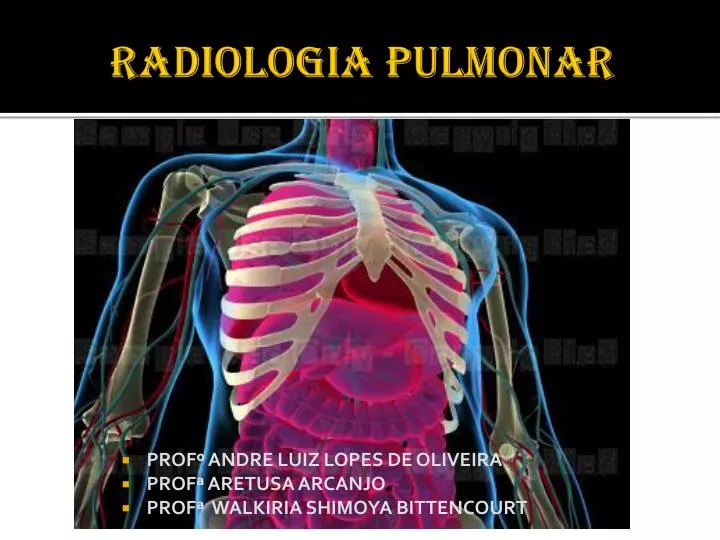 radiologia pulmonar