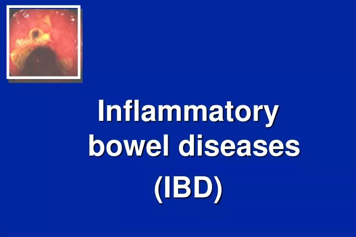 inflammatory bowel diseases ibd