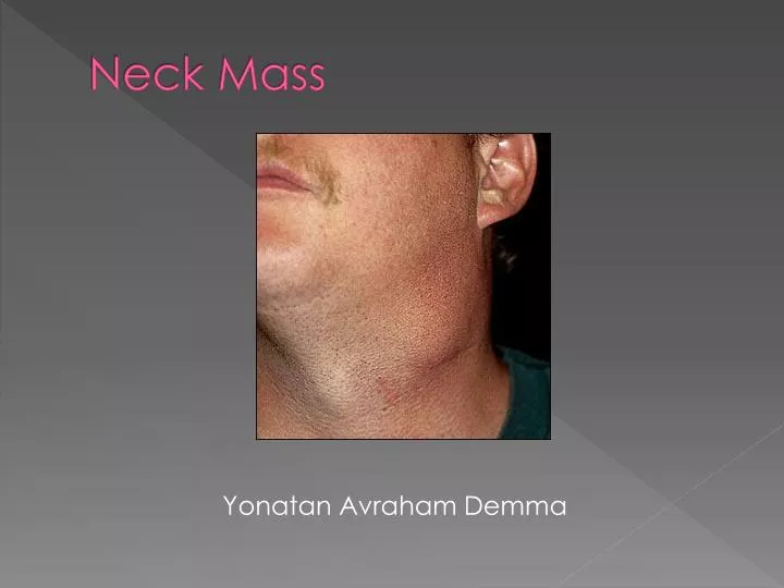 neck mass