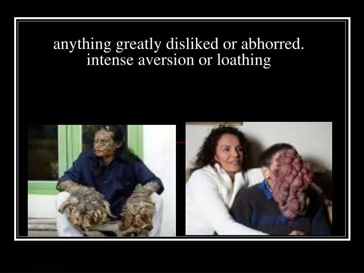 anything greatly disliked or abhorred intense aversion or loathing