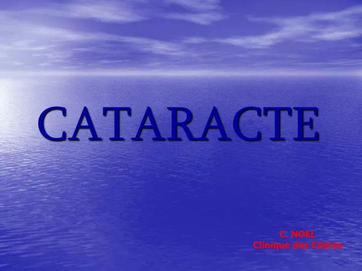 cataracte