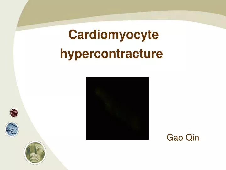 cardiomyocyte hypercontracture