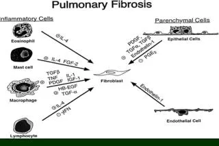 Lung Inflammation
