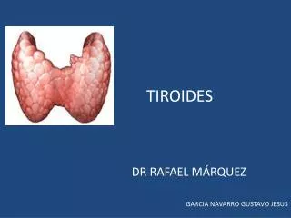 tiroides