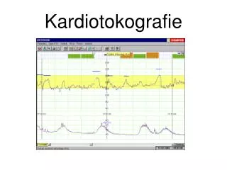 Kardiotokografie