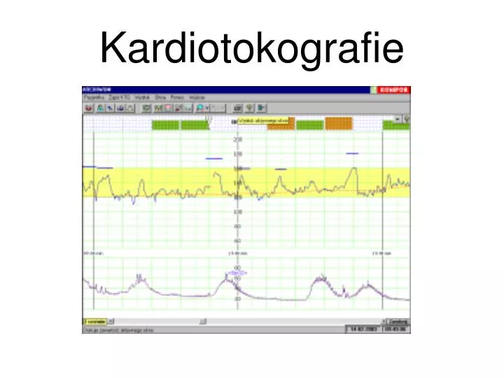 kardiotokografie