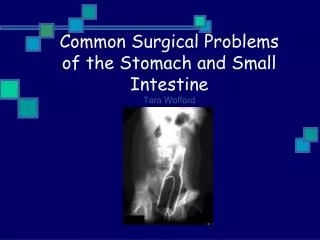 Common Surgical Problems of the Stomach and Small Intestine Tara Wofford