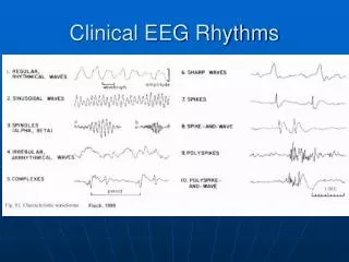 Clinical EEG Rhythms