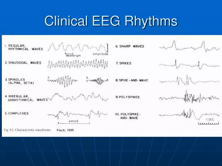 clinical eeg rhythms